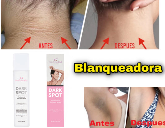 Crema blanqueadora