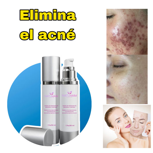 Sistema para el acné